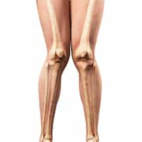 Bow Leg & Knock Knee Correction in Turkey for Nigerians – Transform Your Legs